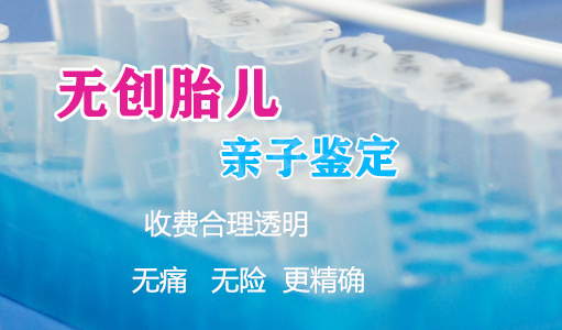 内蒙古专业胎儿亲子鉴定中心哪里有,